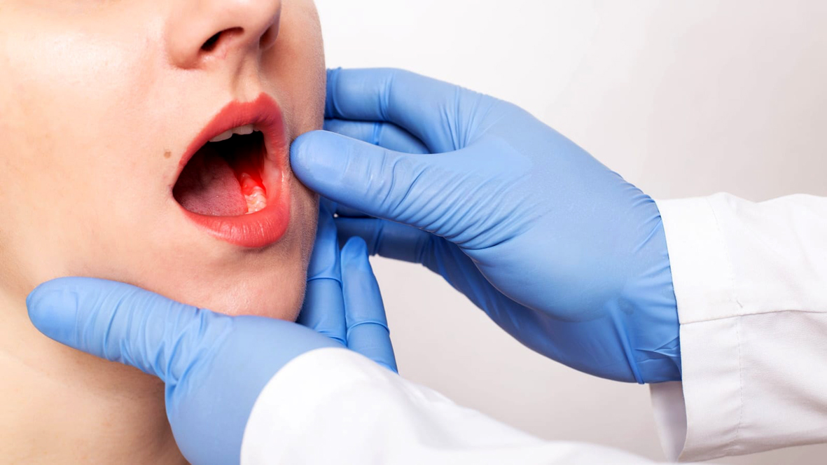 featured-img